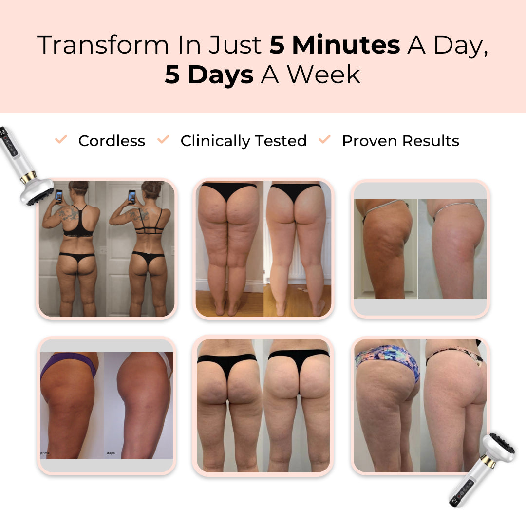 Circulate Pro© Anti-Cellulite Body Massager