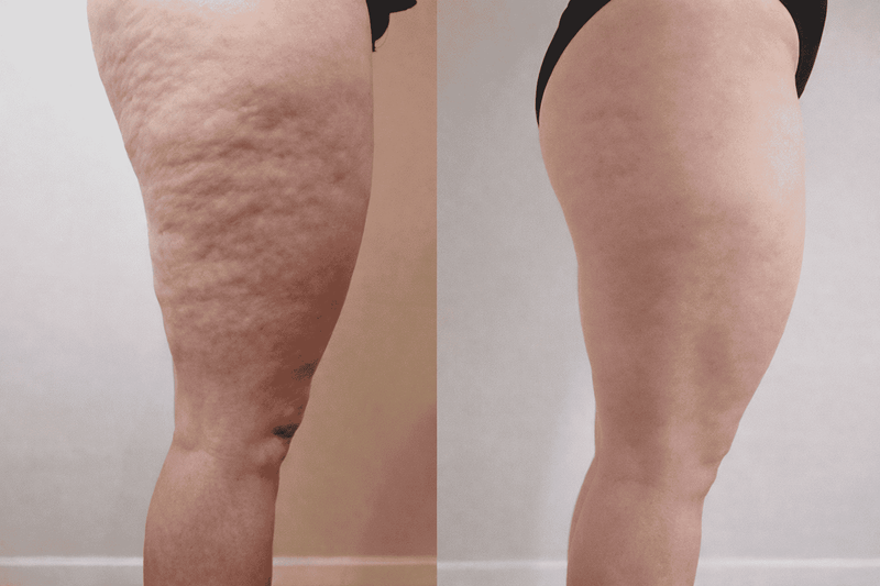 Before and after results