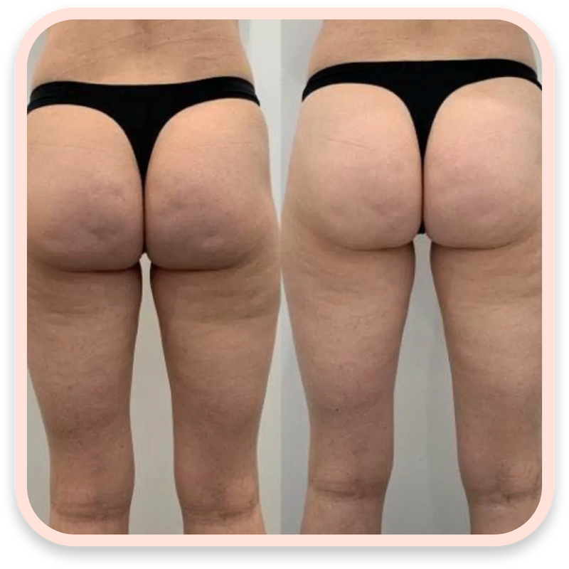 Before and after results