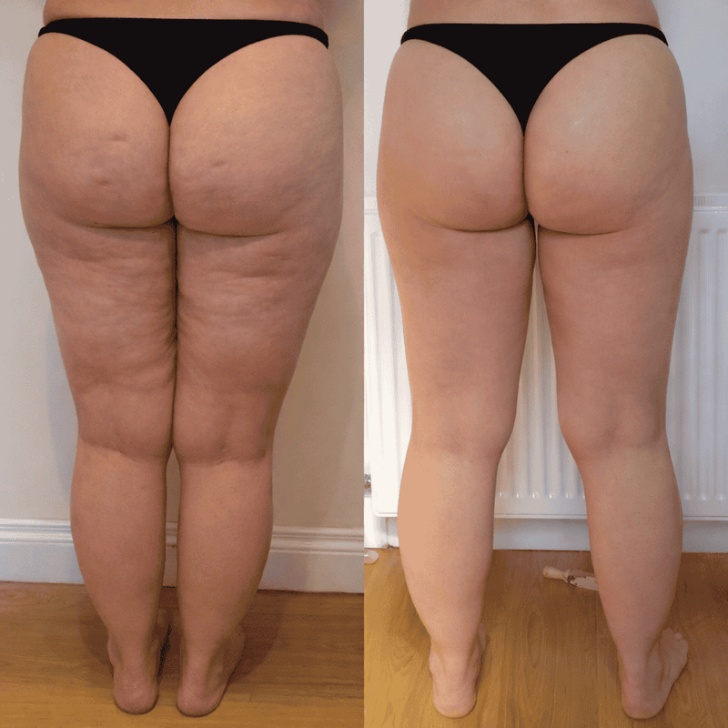 Before and after results