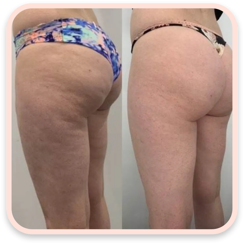 Before and after results